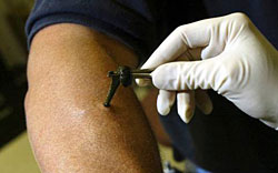 leczenie pijawkami radom